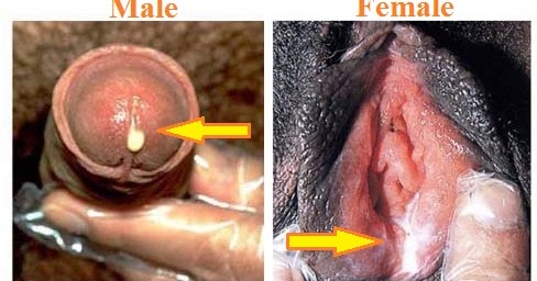 male-and-female